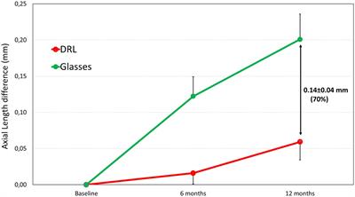 Efficacy of the DRL orthokeratology lens in slowing axial elongation in French children